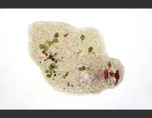 ¿Qué son los protozoarios?